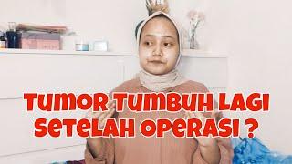 PENGALAMAN PRIBADI !! Tumor Jinak Bisa Tumbuh Lagi ? | Tanty Rahayu