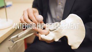 Anterior Hip Replacement