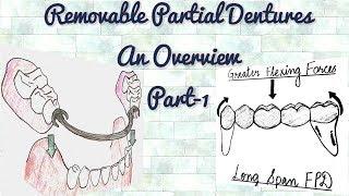 Removable Partial Dentures-An Overview/ Part-1/Indications of RPD