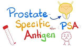 Prostate Cancer Screening - Prostate Specific Antigen (PSA) Test - Large Prostate - Lab results