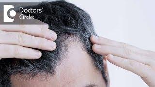 Is it necessary to use minoxidil for transplanted hair? - Dr. Aruna Prasad