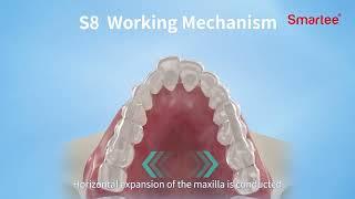 Smartee S8 --- Mandibular Repositioning Technology (SGTB & SGHB)