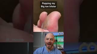 Derm reacts to oozing blister pop! #dermreacts #doctorreacts #blisterpop