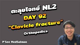 ตะลุยโจทย์ NL2 คละโจทย์ DAY 92 “Clavicle fracture” | MedSalmon ติว NL by พี่ซี