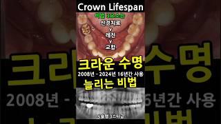크라운 수명 늘리는 비법. 크라운 16년째 사용중인 50세 환자이야기. 신경치료, 레진, 교합 3가지가 중요. 2025_01_04