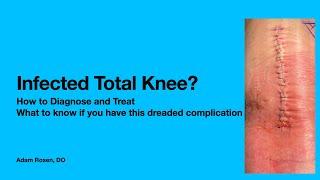 Infected Total Knee Replacement. A dreaded complication. What you need to know.