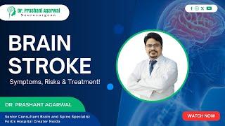 Brain Stroke: Know the Warning Signs & Treatment | Dr. Prashant Agarwal