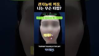 #shorts 당신의 관자놀이는 안녕하십니까 #templefiller