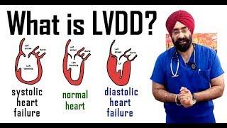 Rx Heart #19 (Hindi) क्या होता है Grade 1 LVDD, Mild Diastolic Dysfunction /Failure - Dr.Education