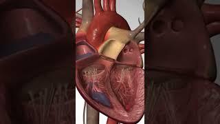 Commotio Cordis: Cardiac Arrest from a Blow to the Chest #cardiacarrest #heartdisease