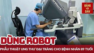 Sử dụng robot phẫu thuật ung thư đại tràng cho bệnh nhân 89 tuổi | Đảng với Dân