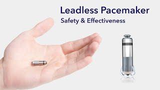 Cardiac Treatment: Leadless Pacemakers