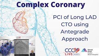 PCI of Long LAD CTO using Antegrade Approach