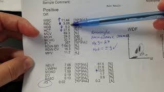 Hematology: How to interpret automated Complete Blood Count (CBC) results