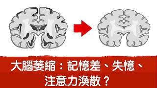 大腦萎縮嗎？記憶差,注意力渙散,再生腦細胞有方法,自然療法,柏格醫生Dr berg