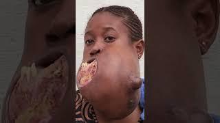  Menina do Congo enfrenta um tumor gigante na sua mandíbula  #MeuCorpoMeuDesafio