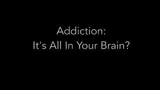 Internet addiction: Is it all in your brain?