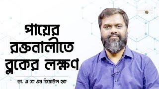 পায়ের রক্তনালীতে ব্লক? কিভাবে বুঝবেন? | ডা. এ কে এম জিয়াউল হক; ভাসকুলার সার্জন