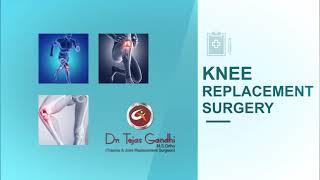 KNEE REPLACEMENT  SURGERY | DR TEJAS GANDHI | AHMEDABAD