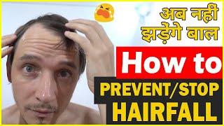  बालो का झड़ना केसे रोके? How to Prevent Hair Fall  #shorts @Shivam Malik