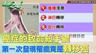 癌症的致命殺手鐧 第一次發現罹癌竟是轉移癌 健康2.0