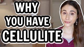 WHY YOU HAVE CELLULITE & HOW TO GET RID OF IT // Dermatologist @DrDrayzday