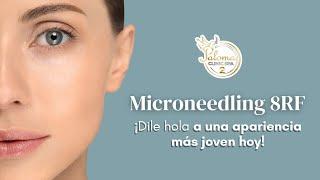 Microneedling 8RF #tratamientofacial #microneedlingrf #pielperfecta #palomaclinicspa #bellezaeterna