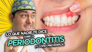 LO QUE NADIE TE DICE DE LA PERIODONTITIS 