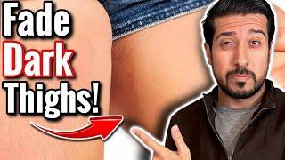 How to Lighten Dark Inner Thighs | 5 EASY Steps to Clear Dark Inner Thighs