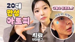 불치병 극복일기 2N년차 아토피랑 싸우는 둥 (feat. 아토피병원, 실비처방, ldm관리,물광에스테틱, 아토피크림추천,더마코스메틱,셀퓨전씨크림)