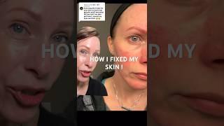 HOW TO FIX a damaged skin barrier  ‼️