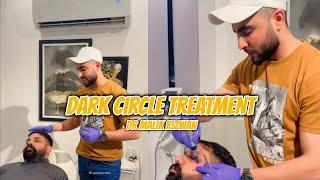 Dark Circle Treatment by Dr Rizwan Malik | @MRAestheticsclinic @malikrizwanofficials | #trending