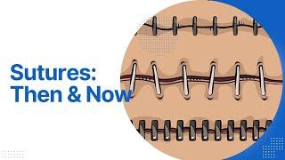 The Incredible Evolution of Sutures: A Journey Through Medical History