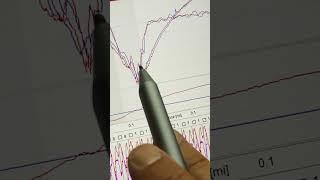 Comparing two close laps (Part 2) - Reviewing gokart race data with RaceStudio 3 and MyChron