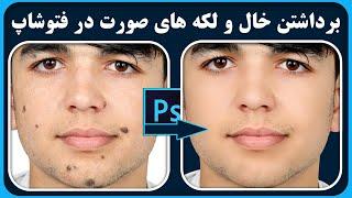 آموزش فتوشاپ | برداشتن خال و لکه های صورت در فتوشاپ | Remove Blemishes in Photoshop