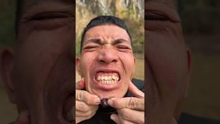How I Cured a Bug Bite with Yogurt in the Wild | Survival Hacks #1589187