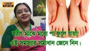 আপনার কি মাঝে মধ্যে পা ফুলে যায়? এই সমস্যার সমাধান জেনে নিন। | EP 135