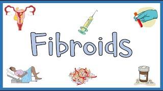 Uterine Fibroids :- Types, Causes, Risk Factors, Signs & Symptoms, Diagnosis & Treatment