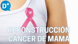 Reconstrucción mamaria para pacientes de cáncer de mama