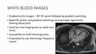 5. CMR Basic Sequences and how to get good images Dr  Pudhiavan