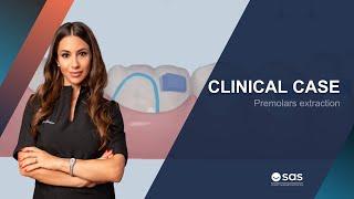 Clinical Case | Premolars extraction - Dr. Lucia Giuliano