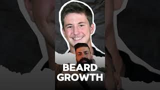 How to Grow a Thick Beard #shorts