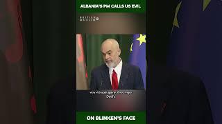 Albania's PM calls US evil on Blinken's face