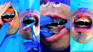 Putting Braces on Mr. Kiwi  P3 Emergency #FruitSurgery #DiscountDentist #FoodSurgery Compilation