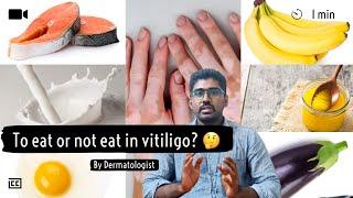 1️⃣ mistake you make can lead to this  | Food & vitiligo