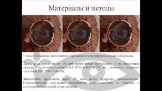 Лазерное излучение (577 нм) микропульс