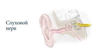 Что приводит к потере слуха?