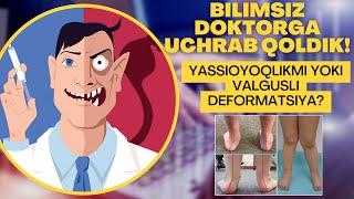 YASSIOYOQLIK YOKI VALGUSLI DEFORMATSIYA? DOKTOR XATO DIAGNOZ QO'YDI!