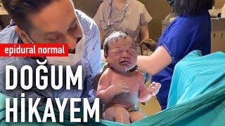 Doğum Hikayem | Epidural Normal Doğum