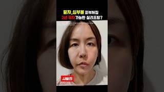 실 리프팅 한 번이면 2년 동안 팔자주름, 심부볼  걱정이 끝!? #실리프팅  #주름